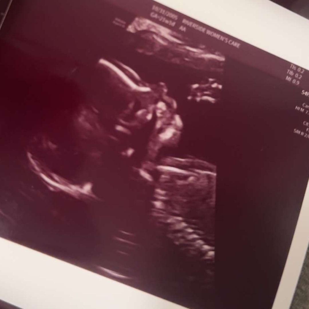 Photo shared by Grace for their Babylist baby registry.