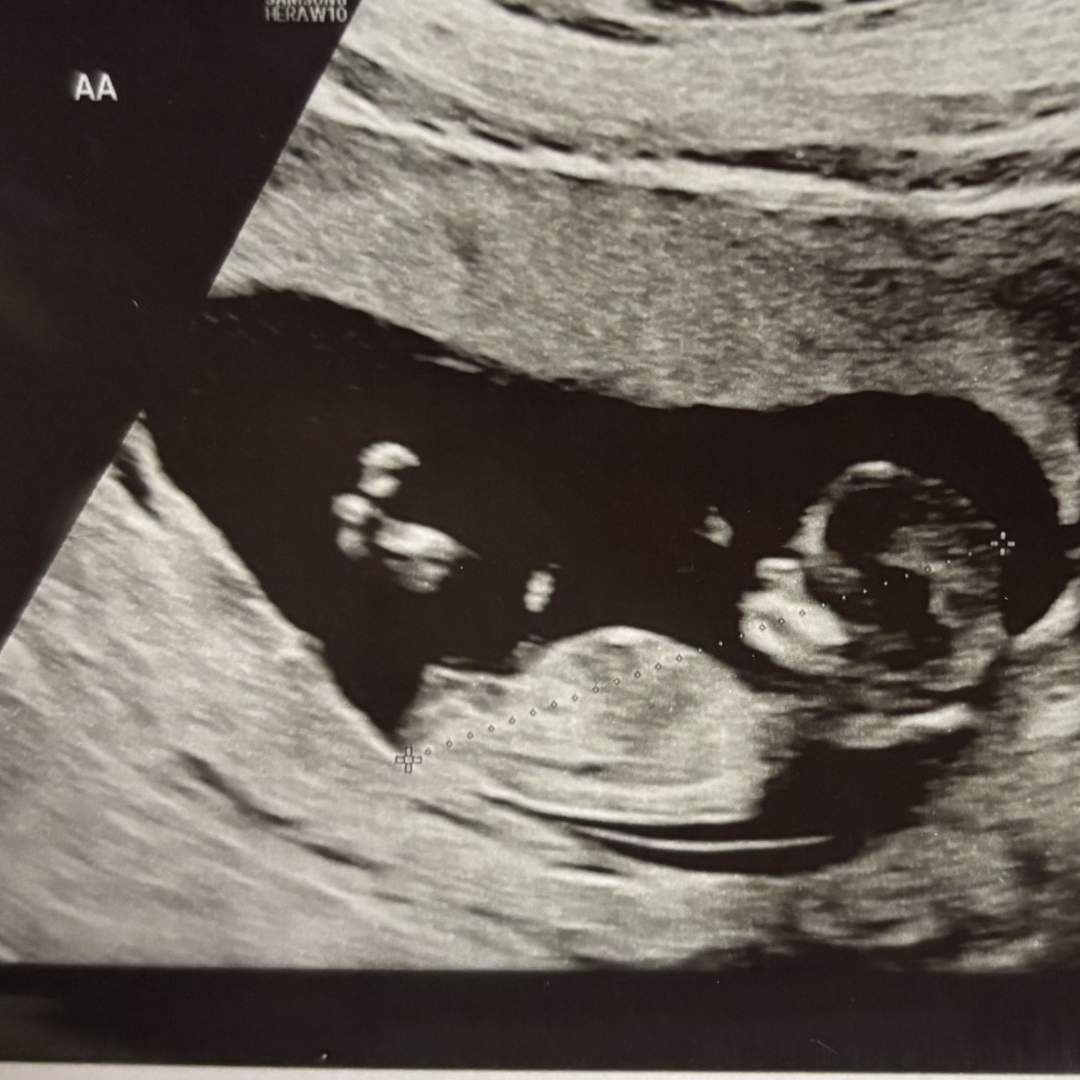 Photo shared by Danielle for their Babylist baby registry.