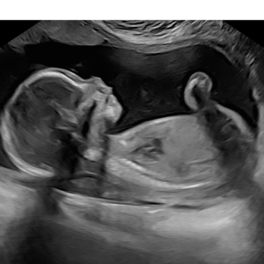 Photo shared by Lindsey for their Babylist baby registry.