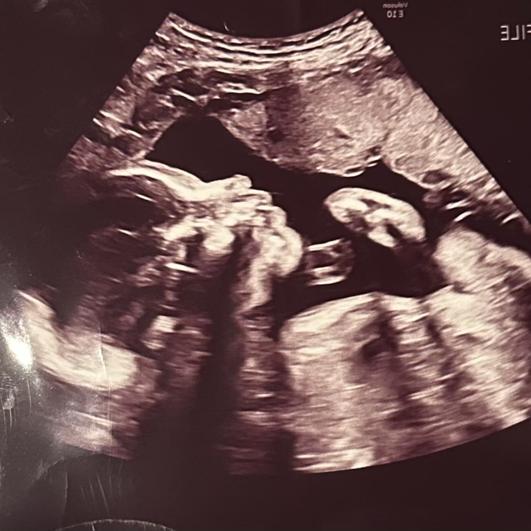 Photo shared by Malaak for their Babylist baby registry.