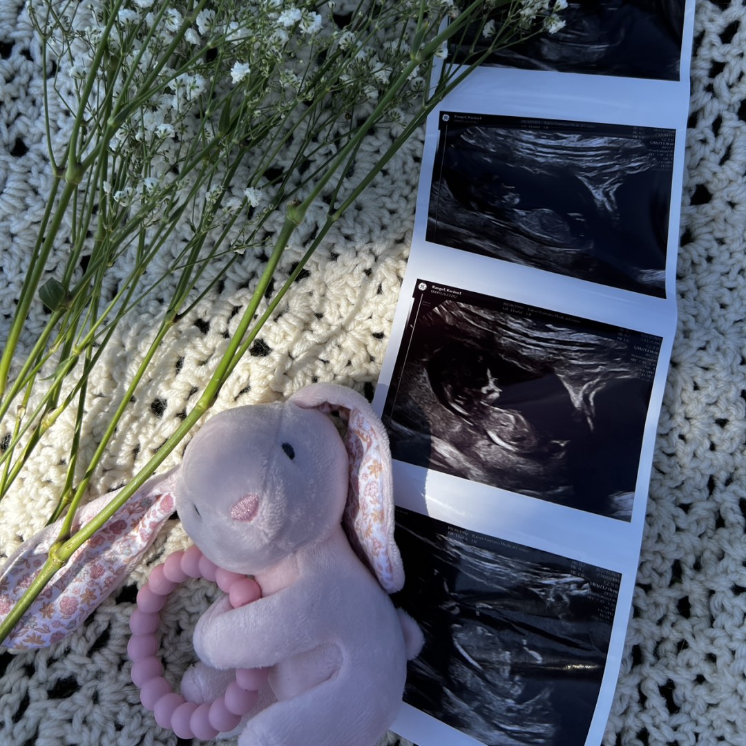 Photo shared by Karina for their Babylist baby registry.