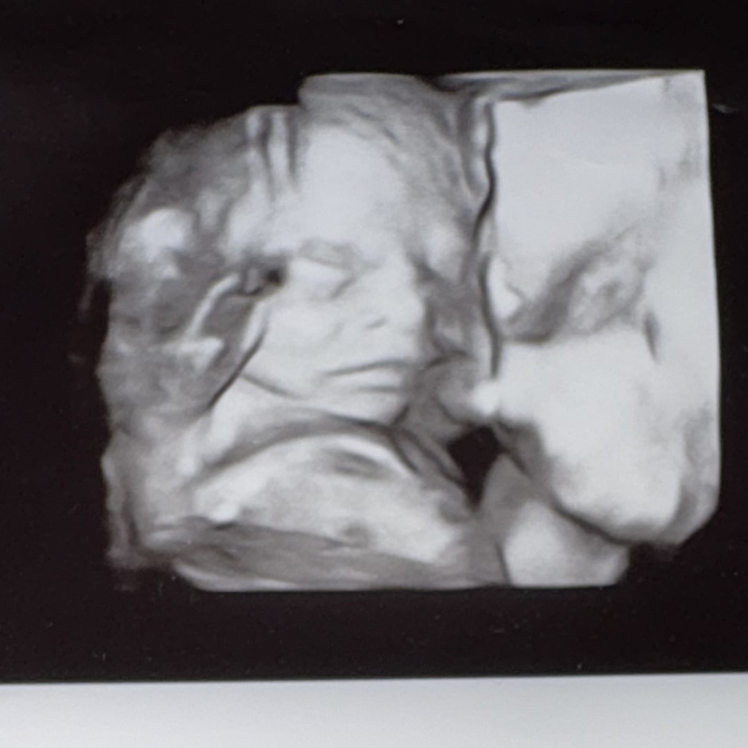 Photo shared by Chai for their Babylist baby registry.