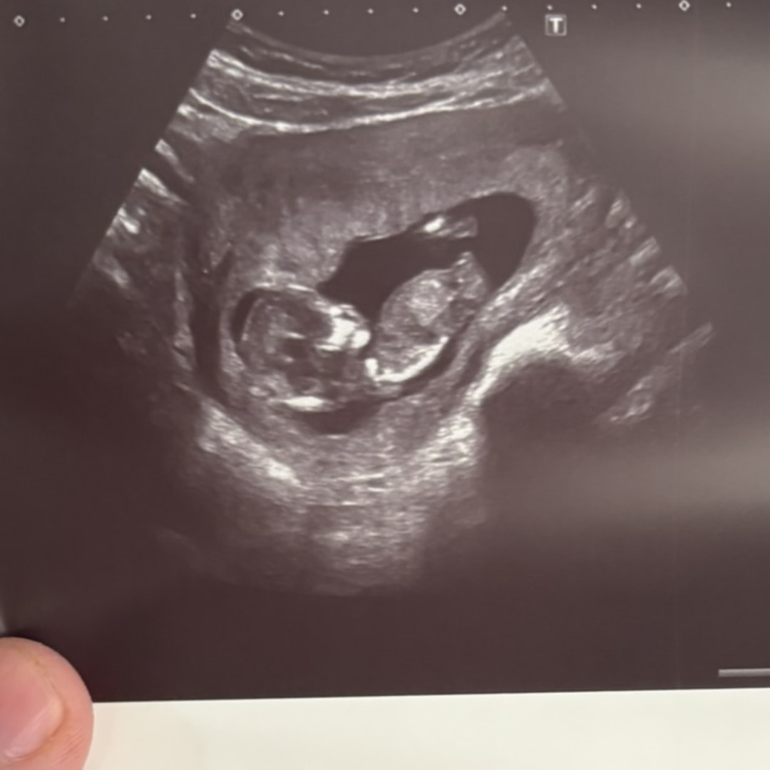 Photo shared by Kayla for their Babylist baby registry.