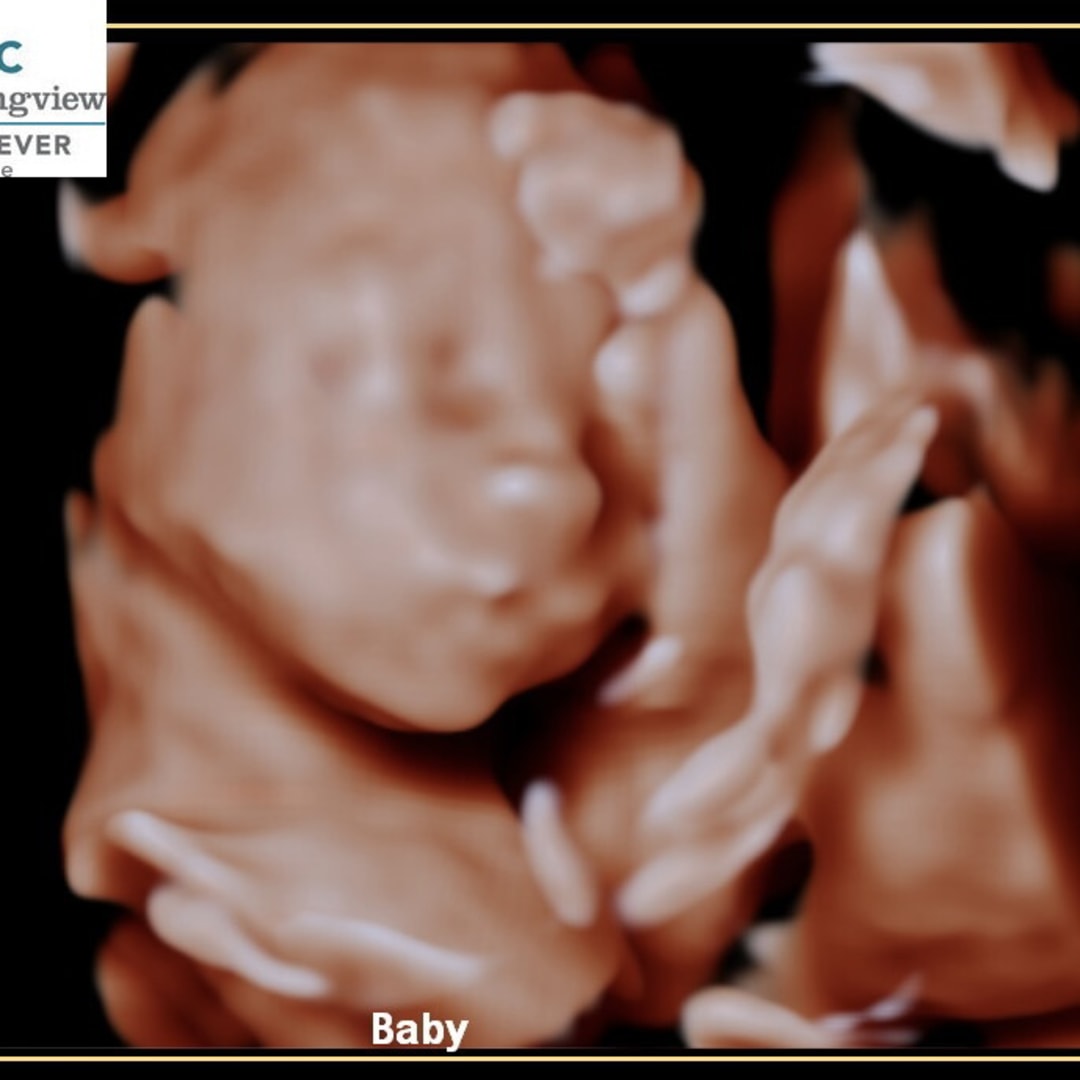 Photo shared by Brittany for their Babylist baby registry.