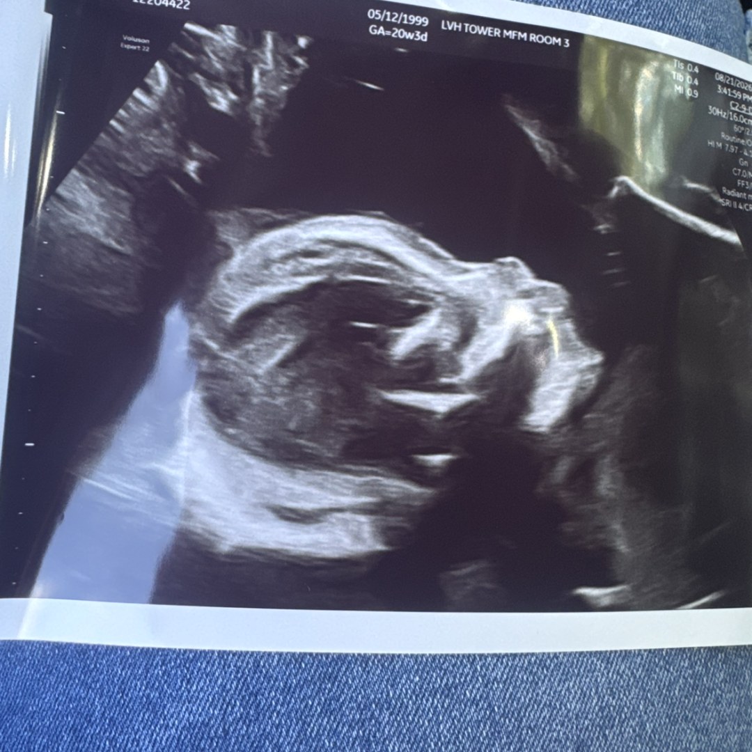 Photo shared by Alyssa for their Babylist baby registry.