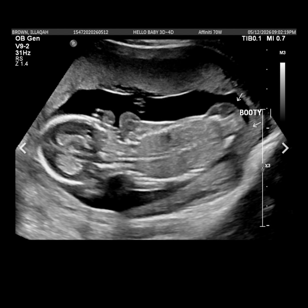 Photo shared by Illaqah for their Babylist baby registry.
