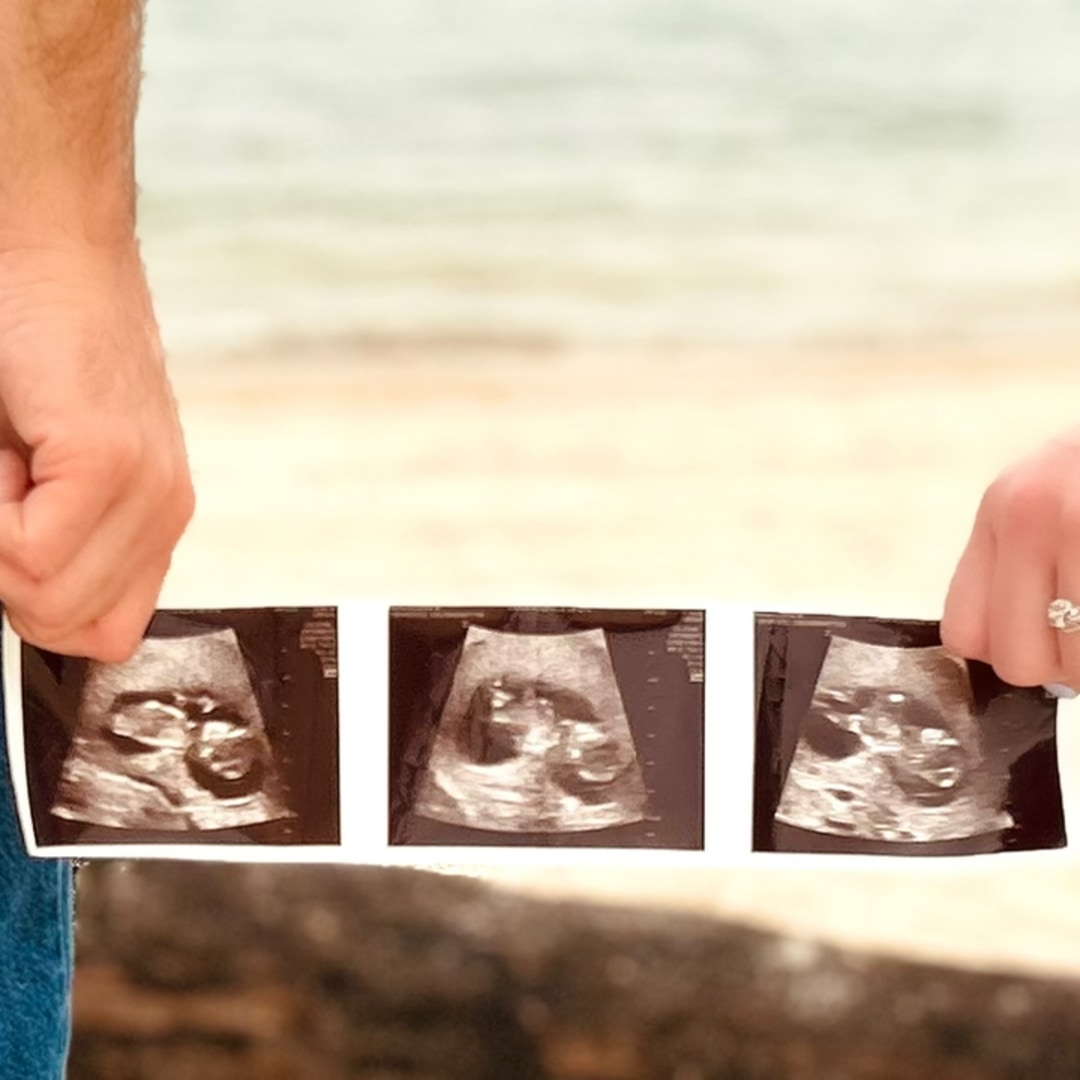 Photo shared by Lyndie for their Babylist baby registry.