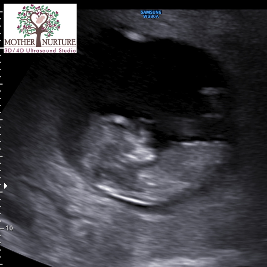 Photo shared by Cheryl for their Babylist baby registry.