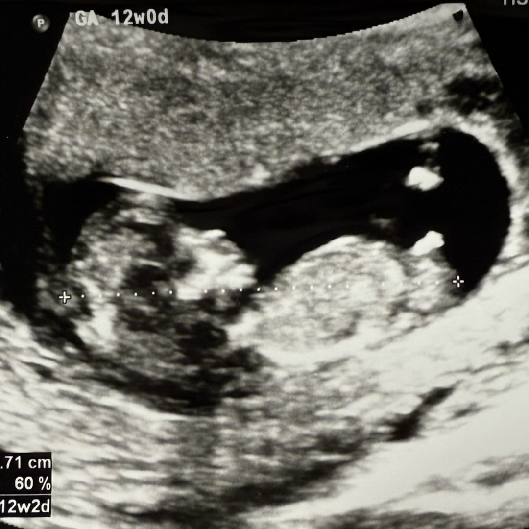 Photo shared by Cylie for their Babylist baby registry.