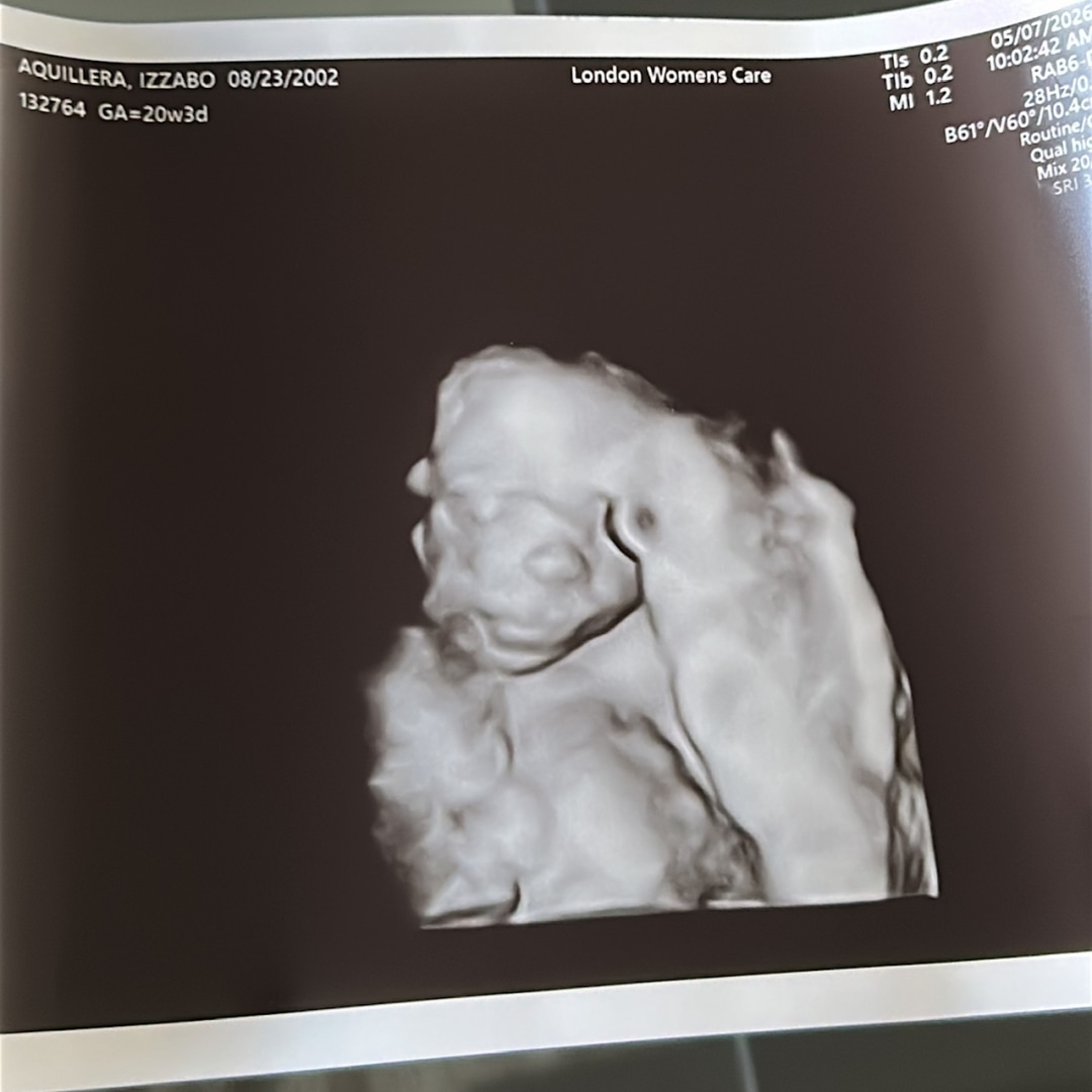 Photo shared by Izzabo for their Babylist baby registry.