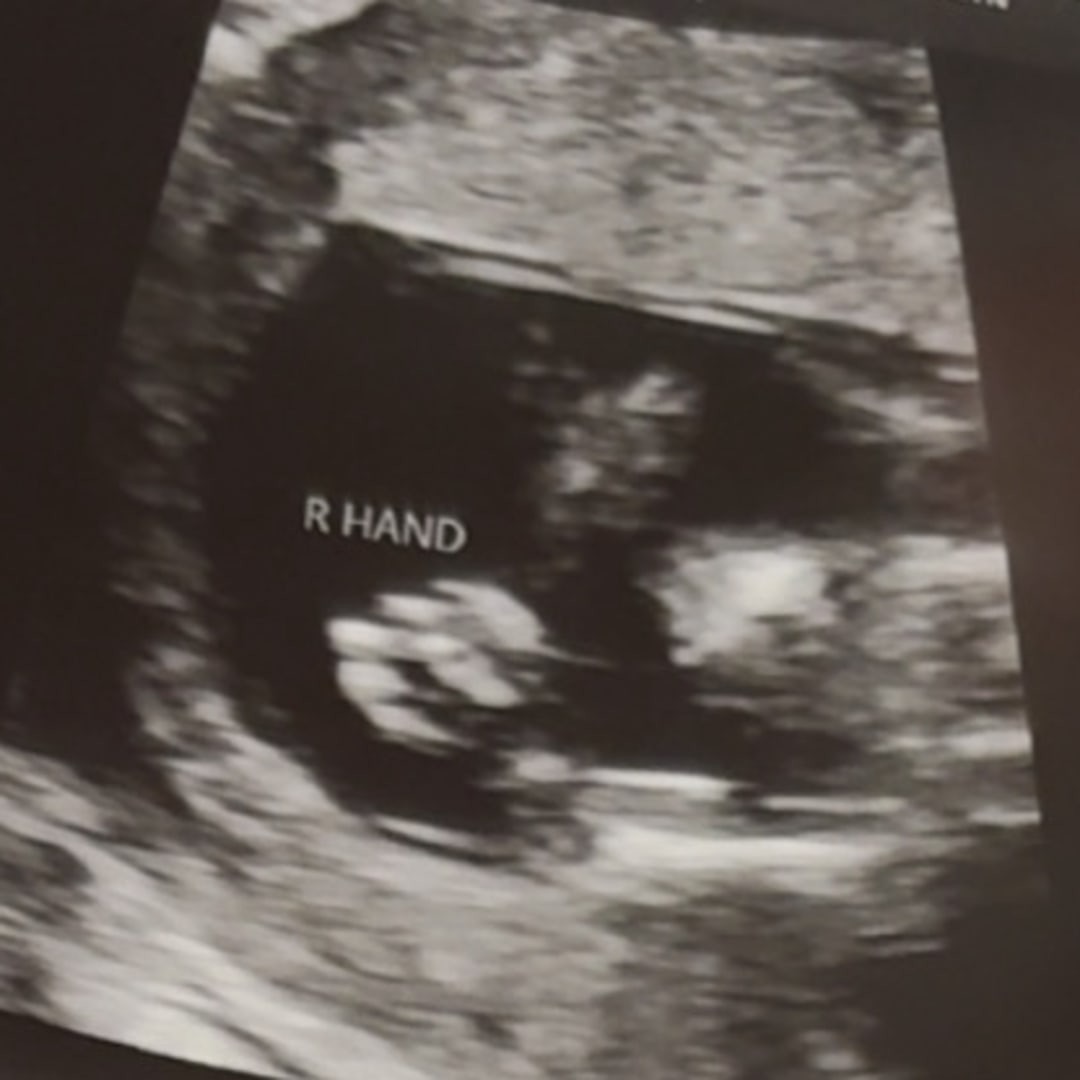 Photo shared by Callan for their Babylist baby registry.