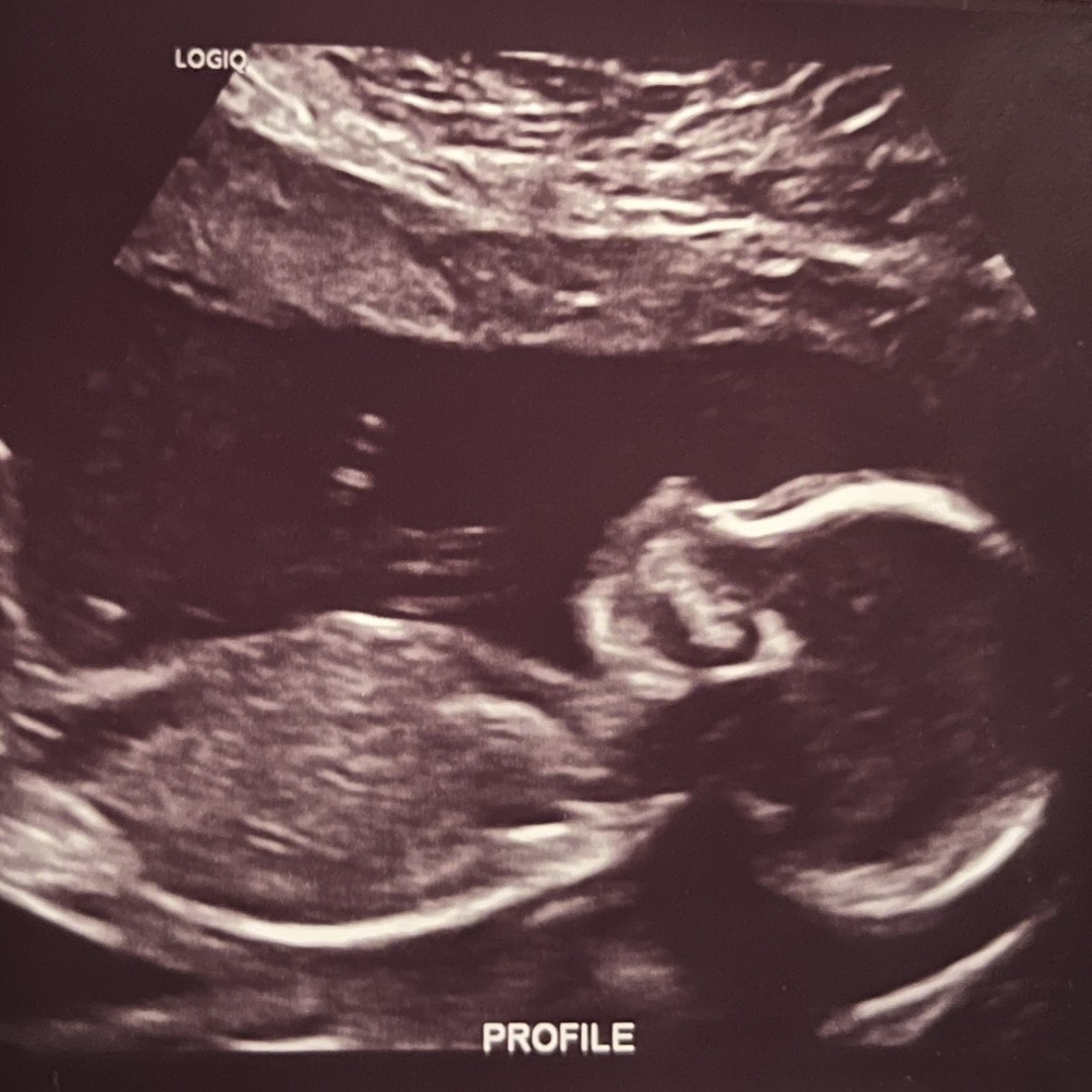 Photo shared by Bailey for their Babylist baby registry.