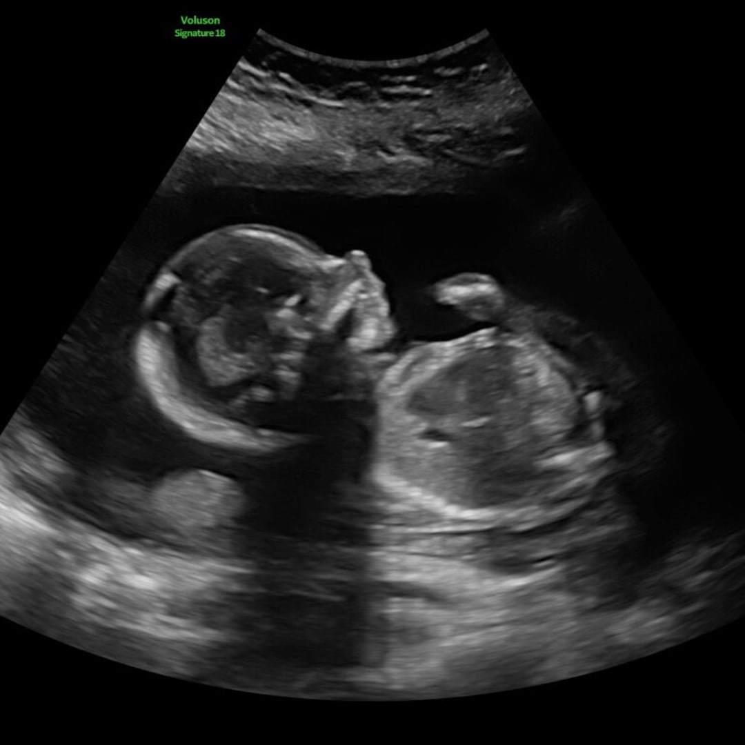 Photo shared by Lauren for their Babylist baby registry.