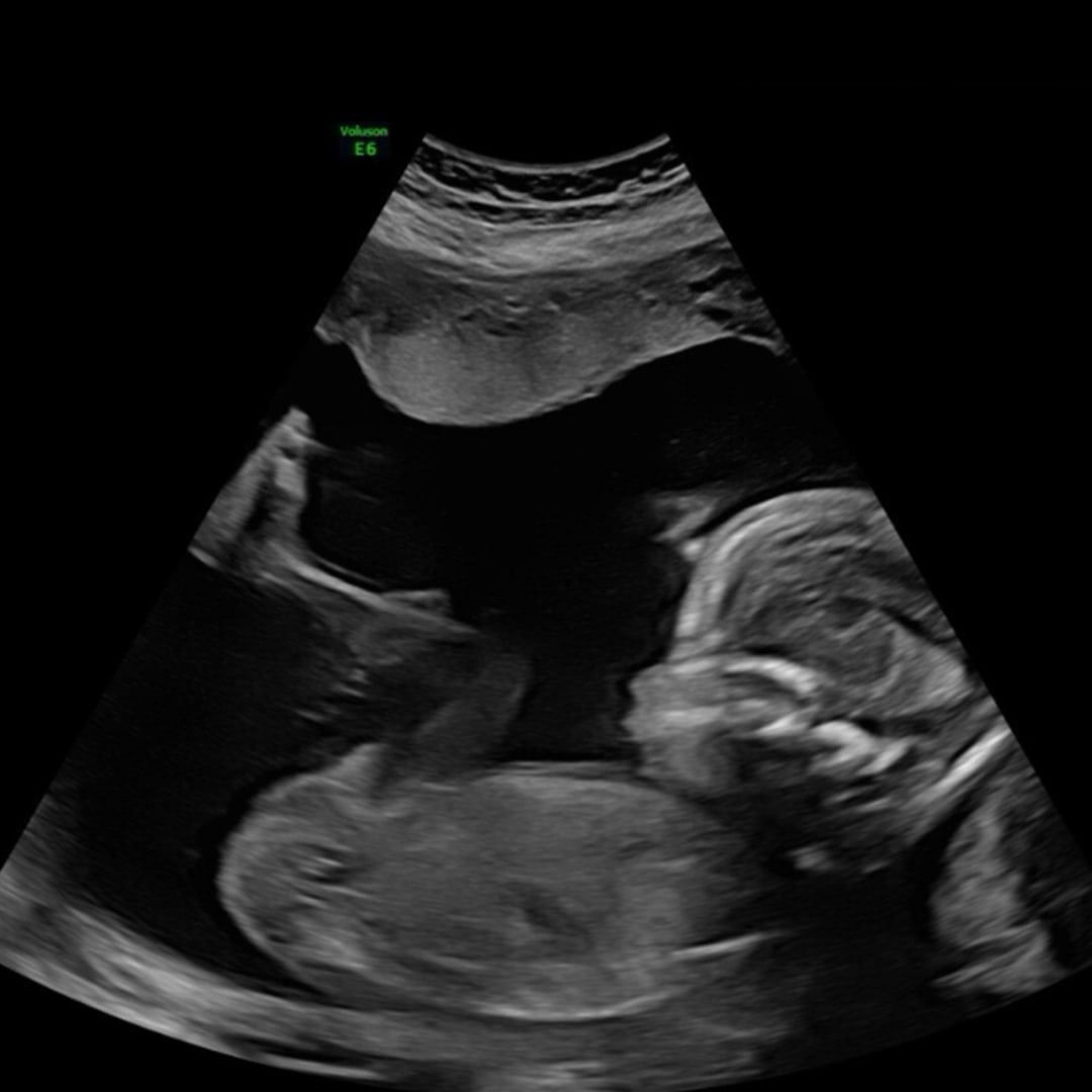 Photo shared by Elizabeth for their Babylist baby registry.