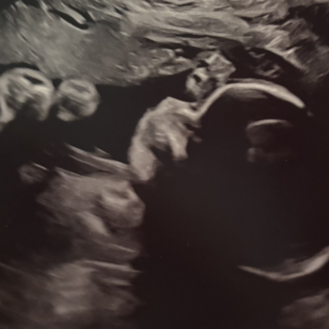 Photo shared by Hailey for their Babylist baby registry.