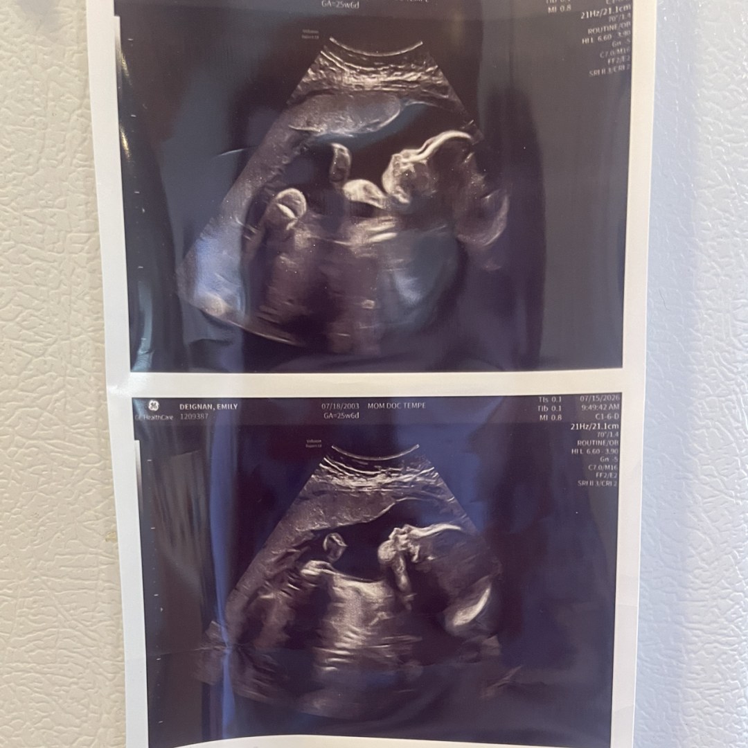 Photo shared by Emily for their Babylist baby registry.