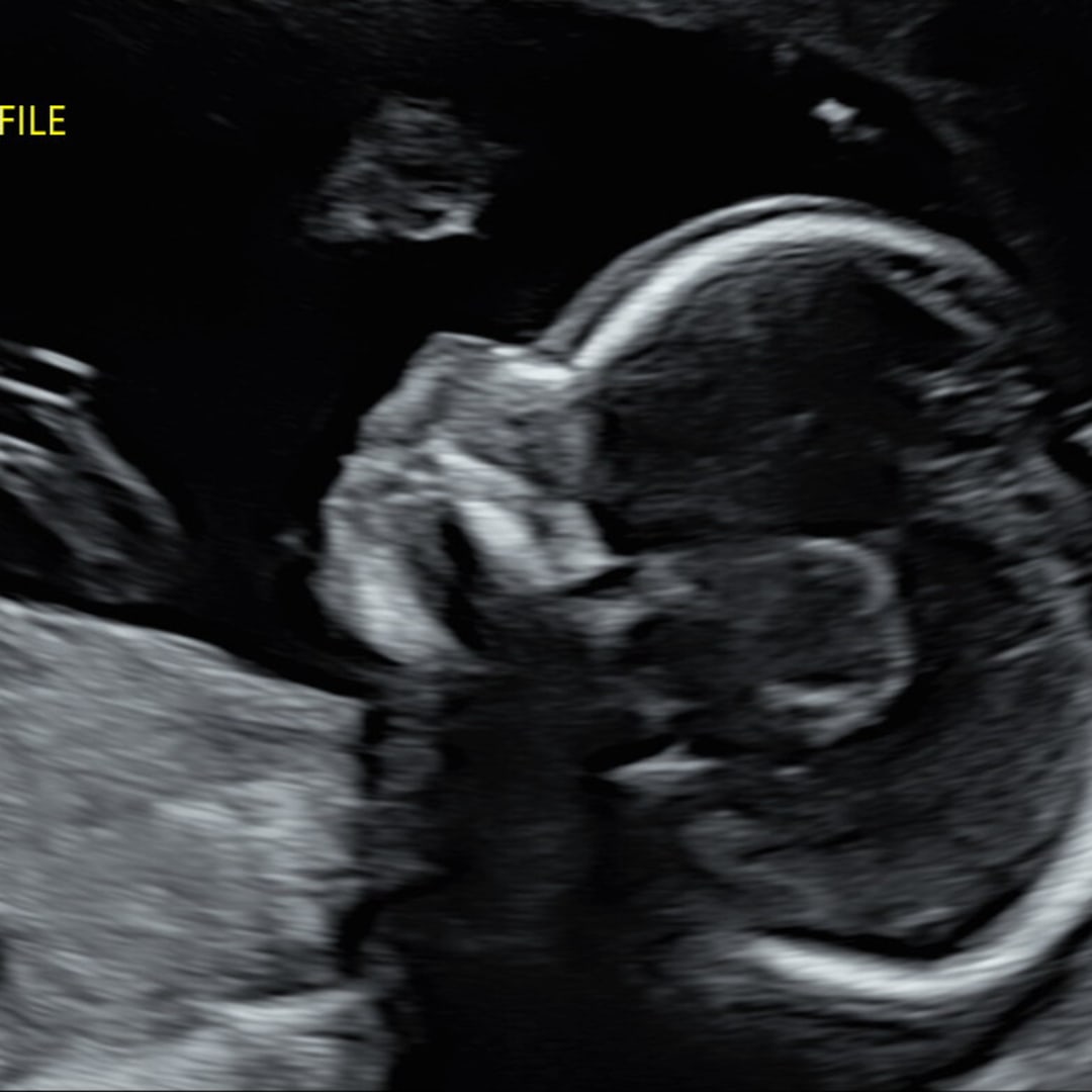 Photo shared by Chantal for their Babylist baby registry.