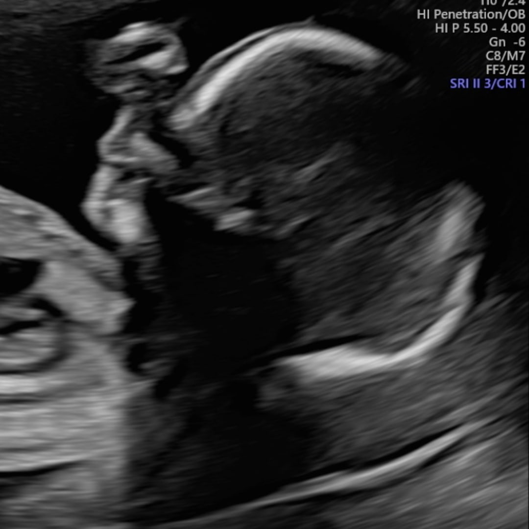 Photo shared by Jacob & Jessica for their Babylist baby registry.
