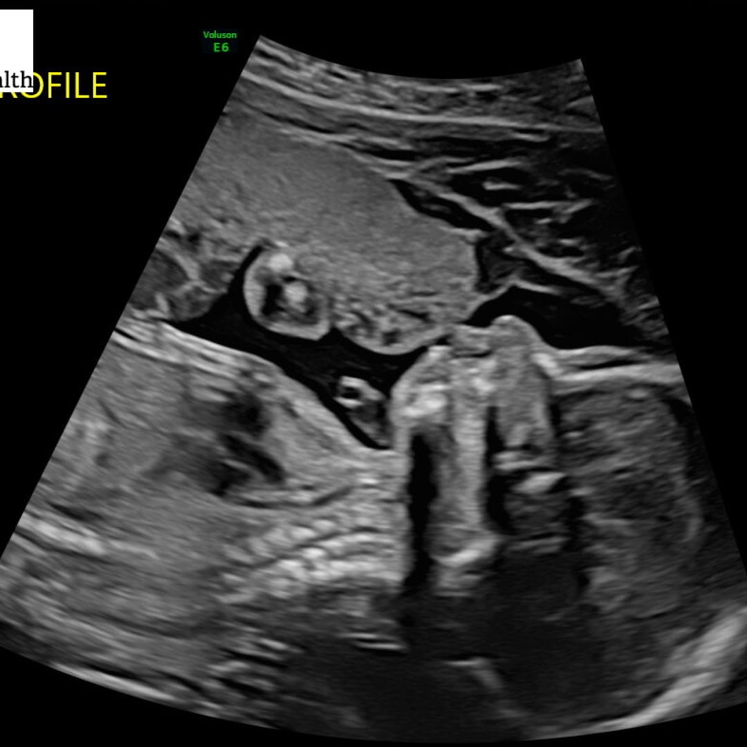 Photo shared by Sheldon for their Babylist baby registry.
