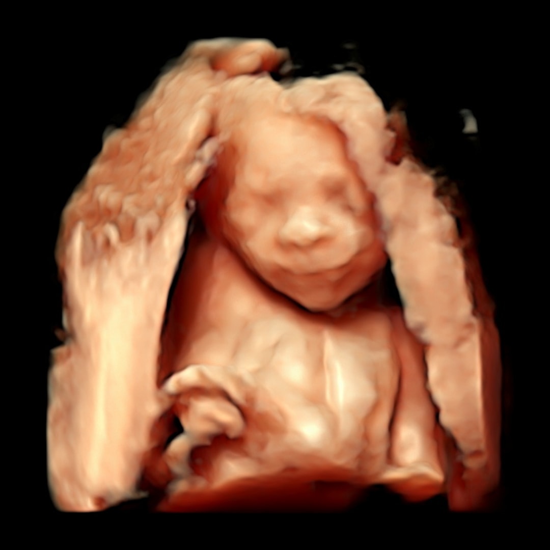 Photo shared by Alyssa for their Babylist baby registry.