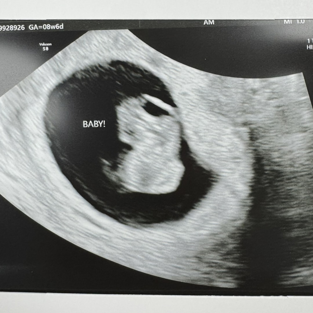 Photo shared by Amber for their Babylist baby registry.