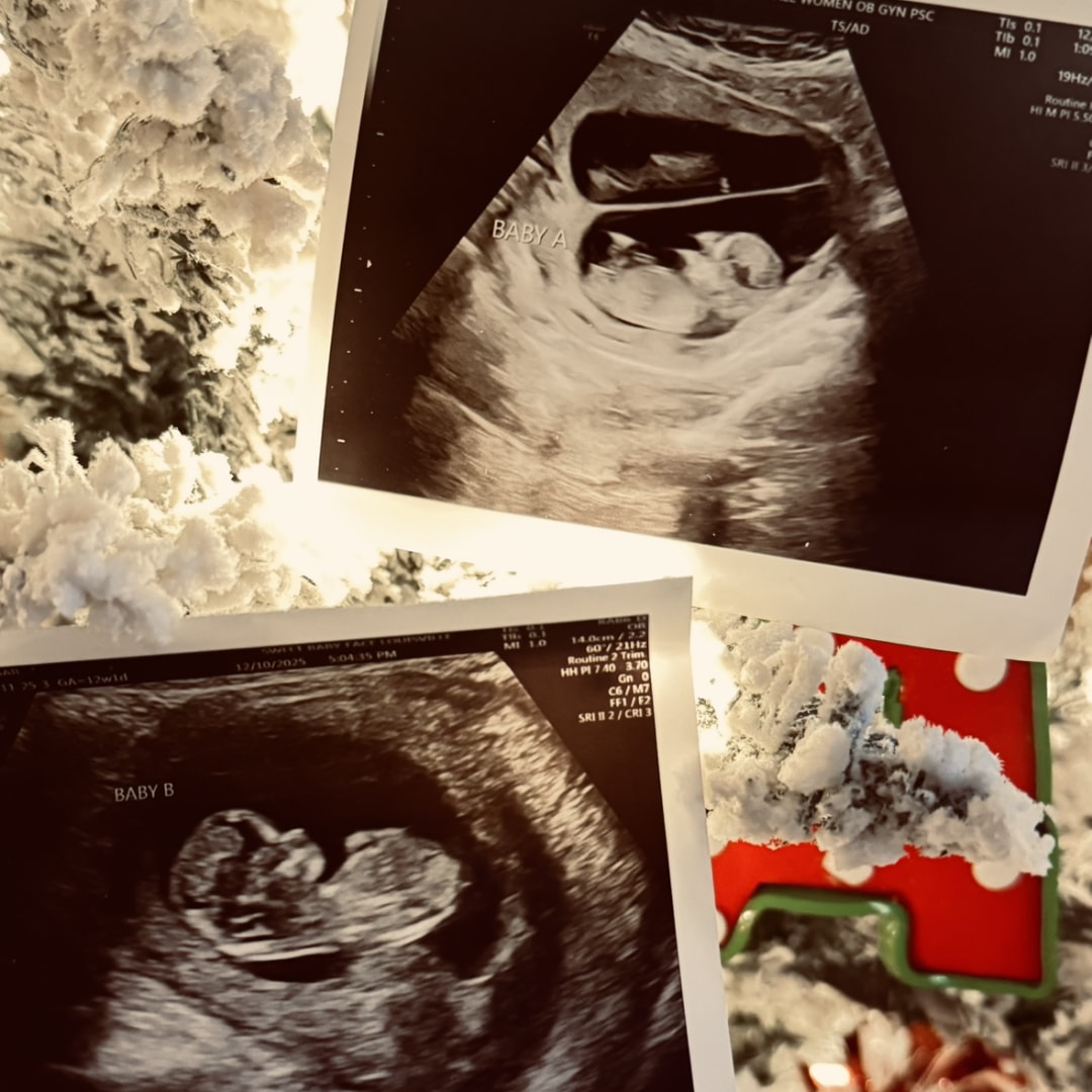 Photo shared by Abbie for their Babylist baby registry.