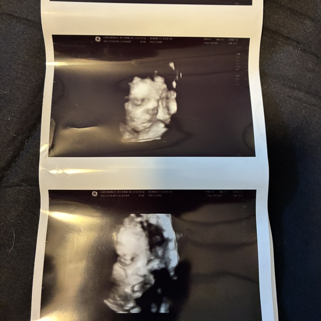 Photo shared by Taylor for their Babylist baby registry.
