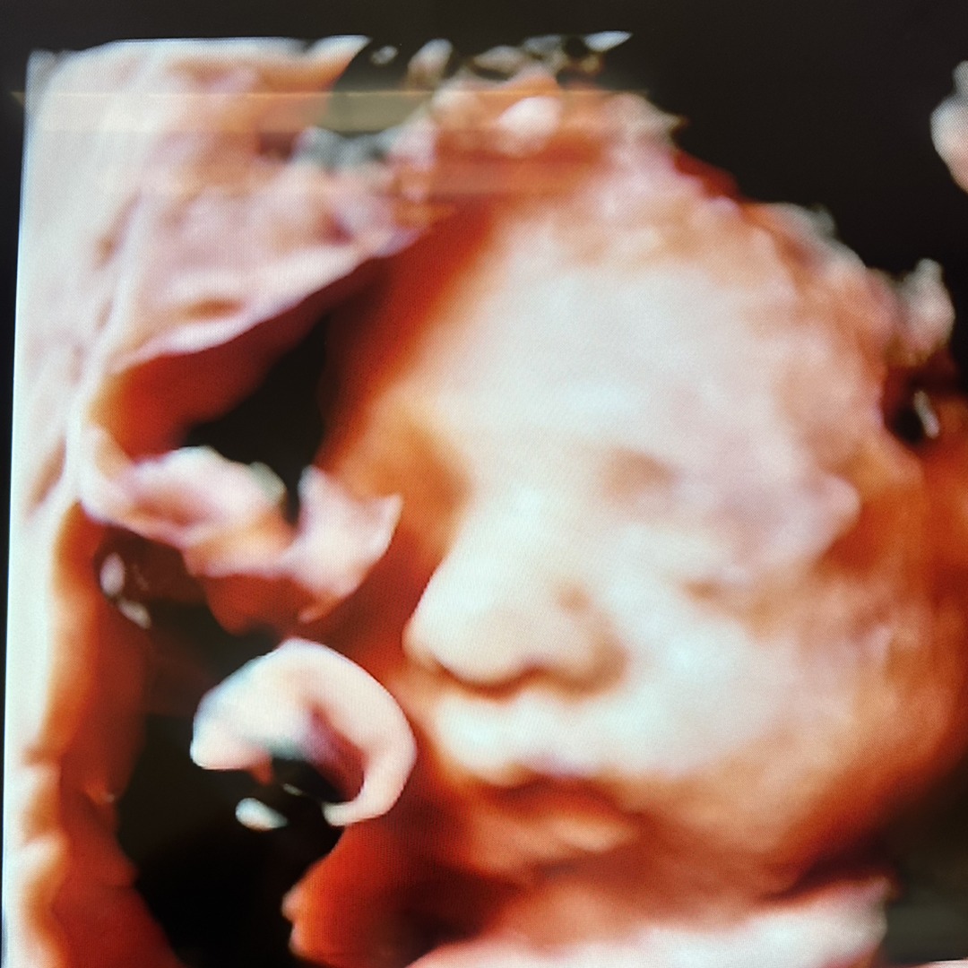 Photo shared by Aly for their Babylist baby registry.