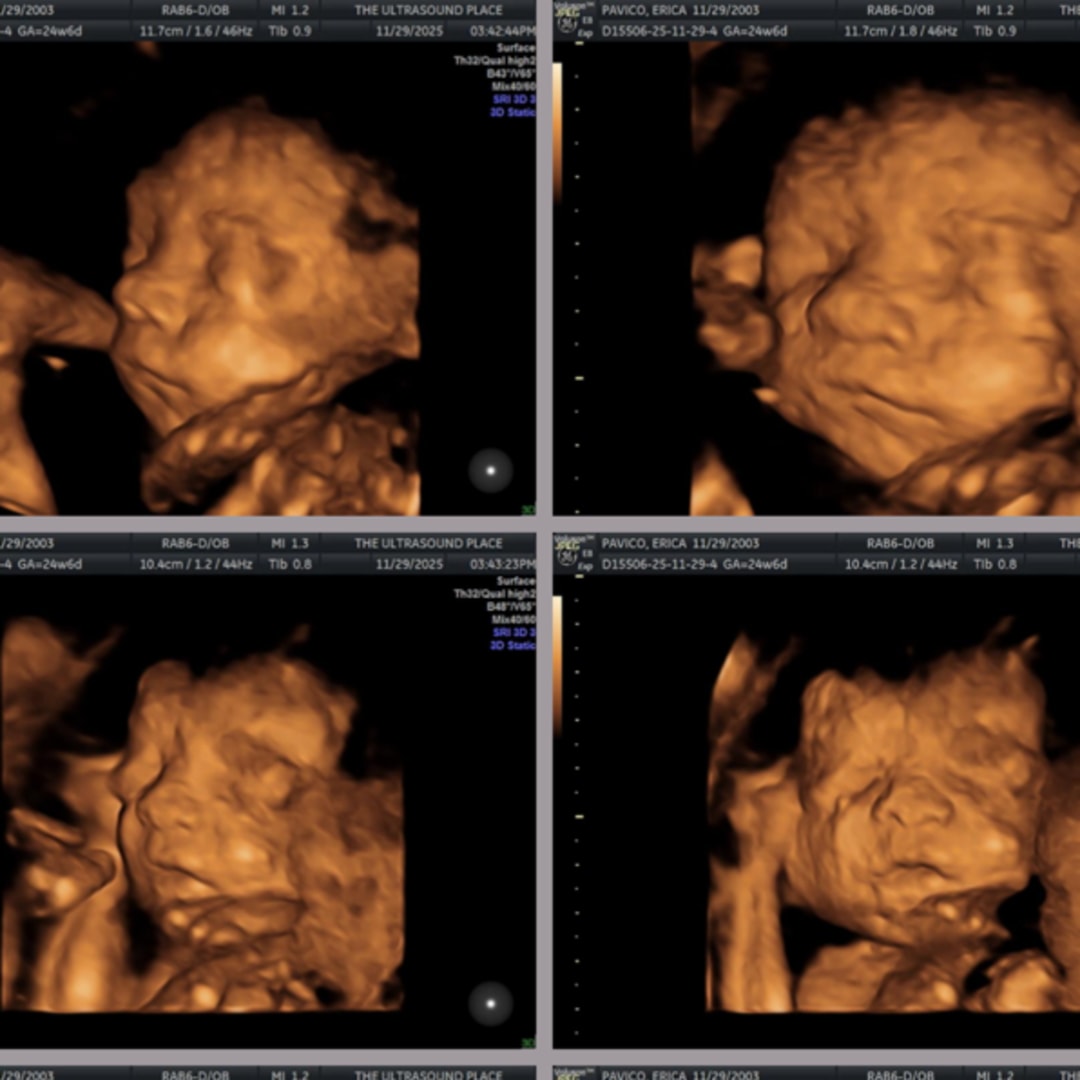 Photo shared by Erika for their Babylist baby registry.