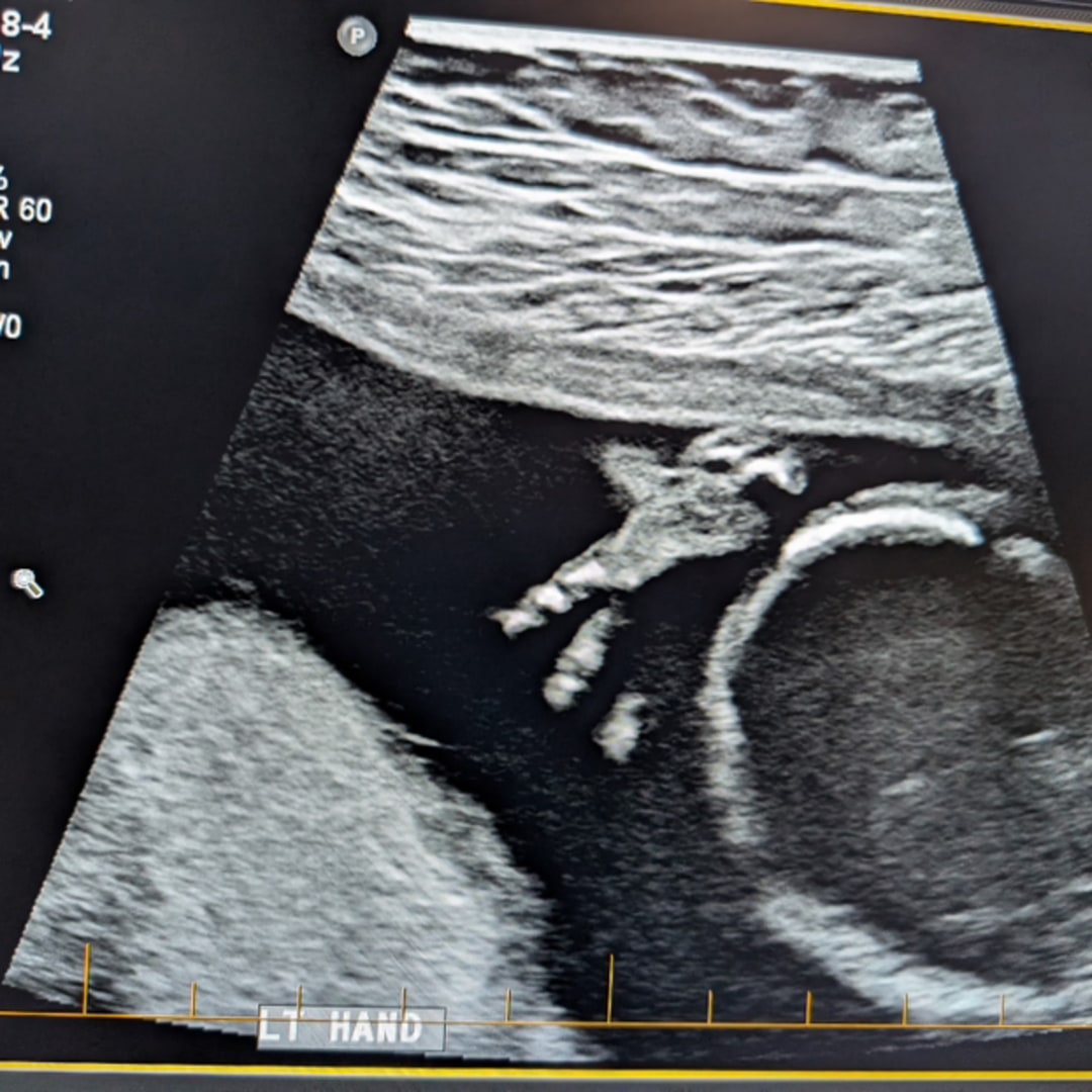 Photo shared by Talya for their Babylist baby registry.