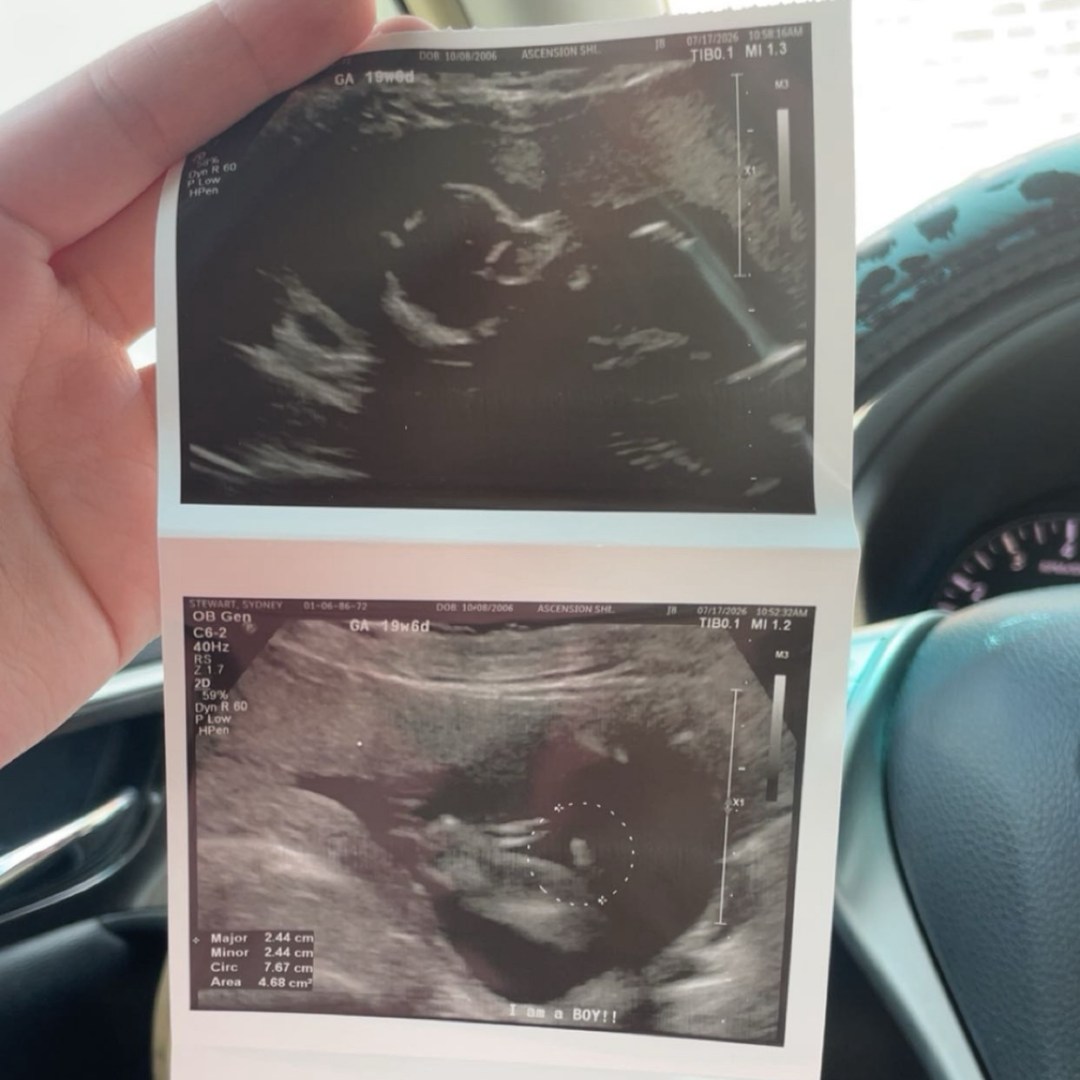 Photo shared by Sydney for their Babylist baby registry.
