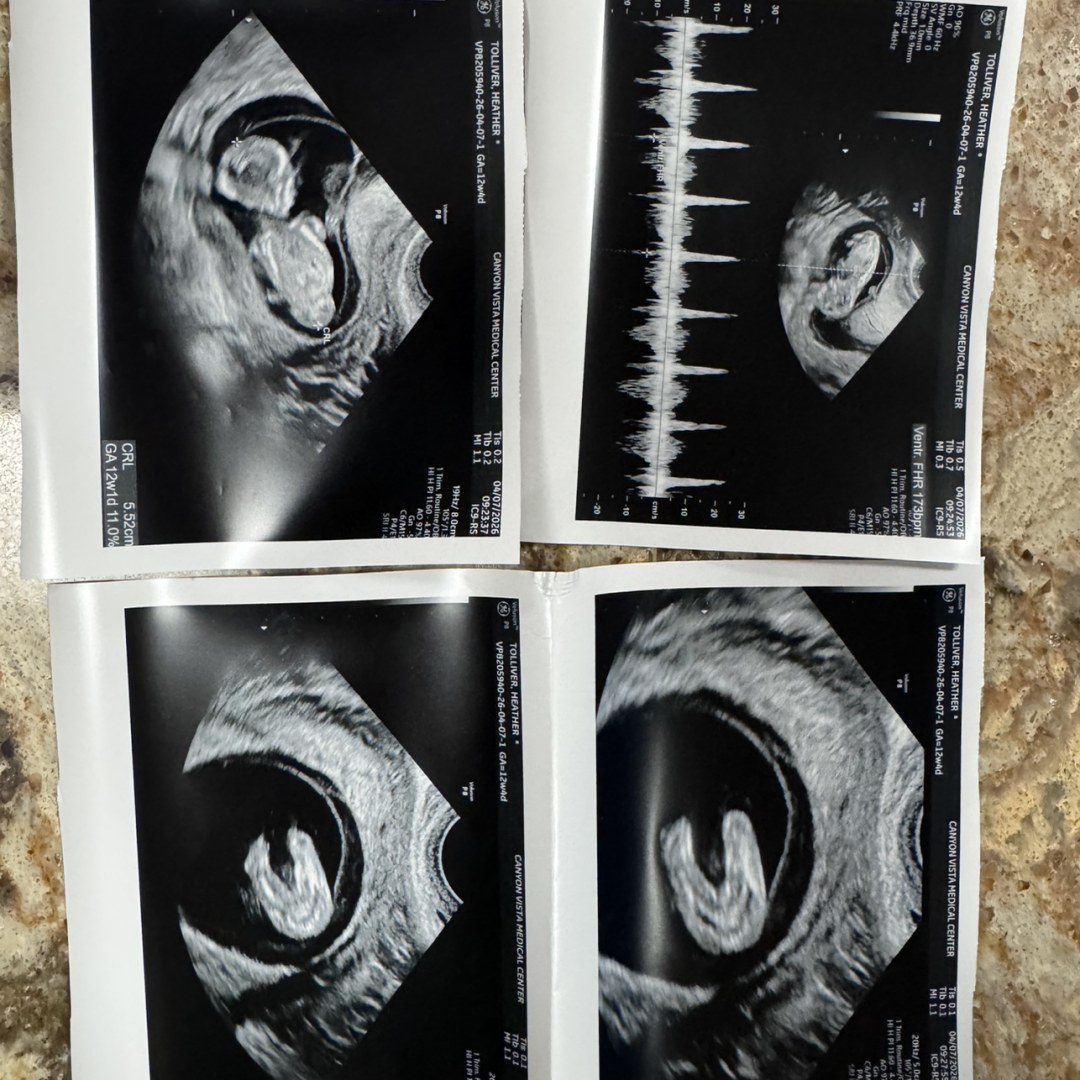 Photo shared by Heather for their Babylist baby registry.