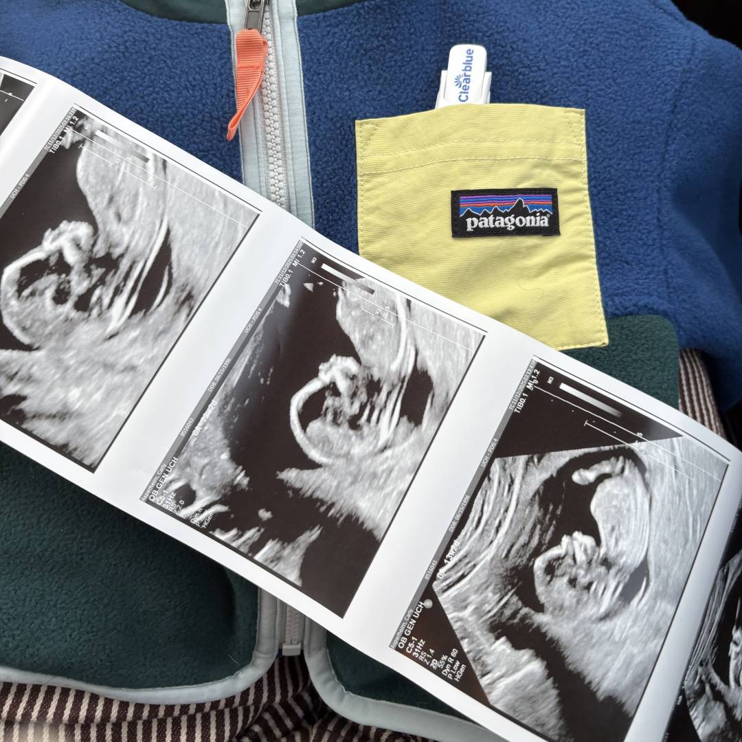 Photo shared by Carly for their Babylist baby registry.