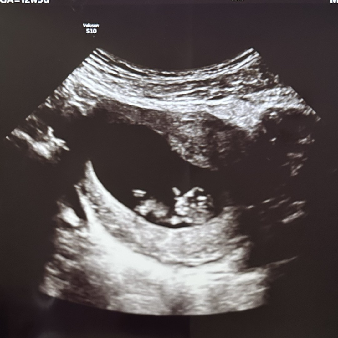 Photo shared by Hayli for their Babylist baby registry.