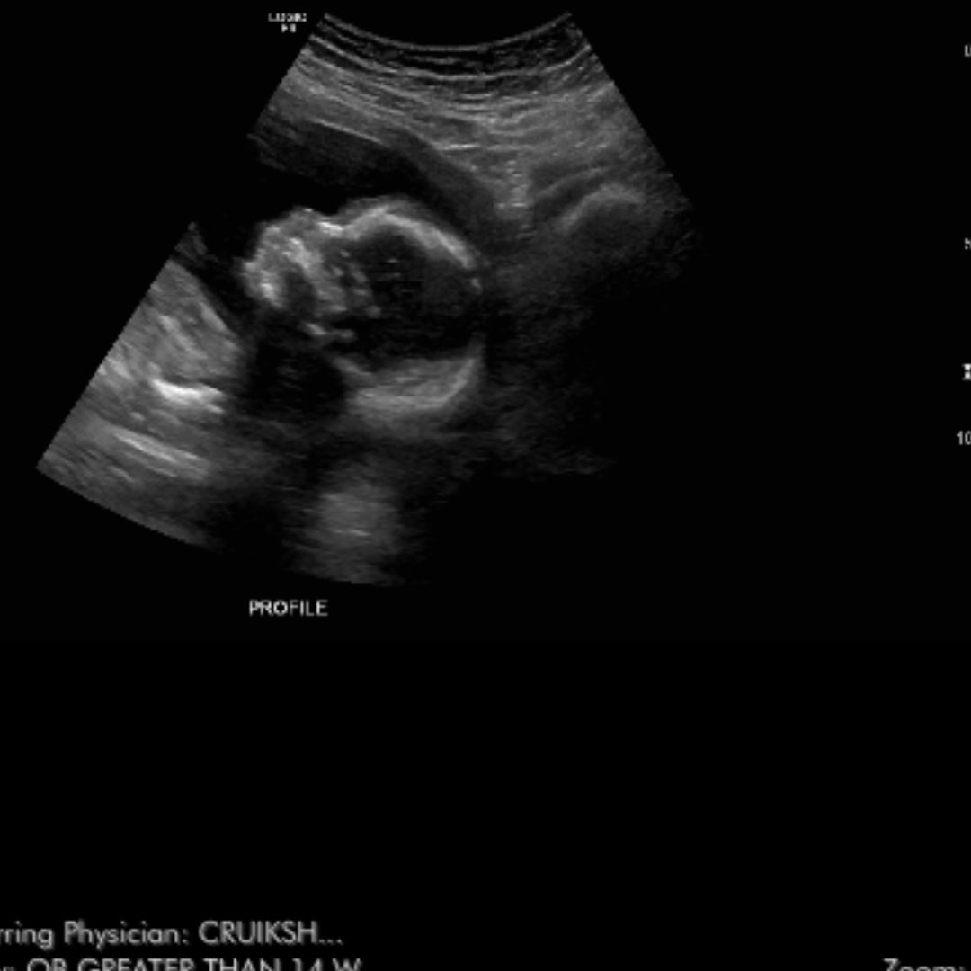 Photo shared by Paige for their Babylist baby registry.