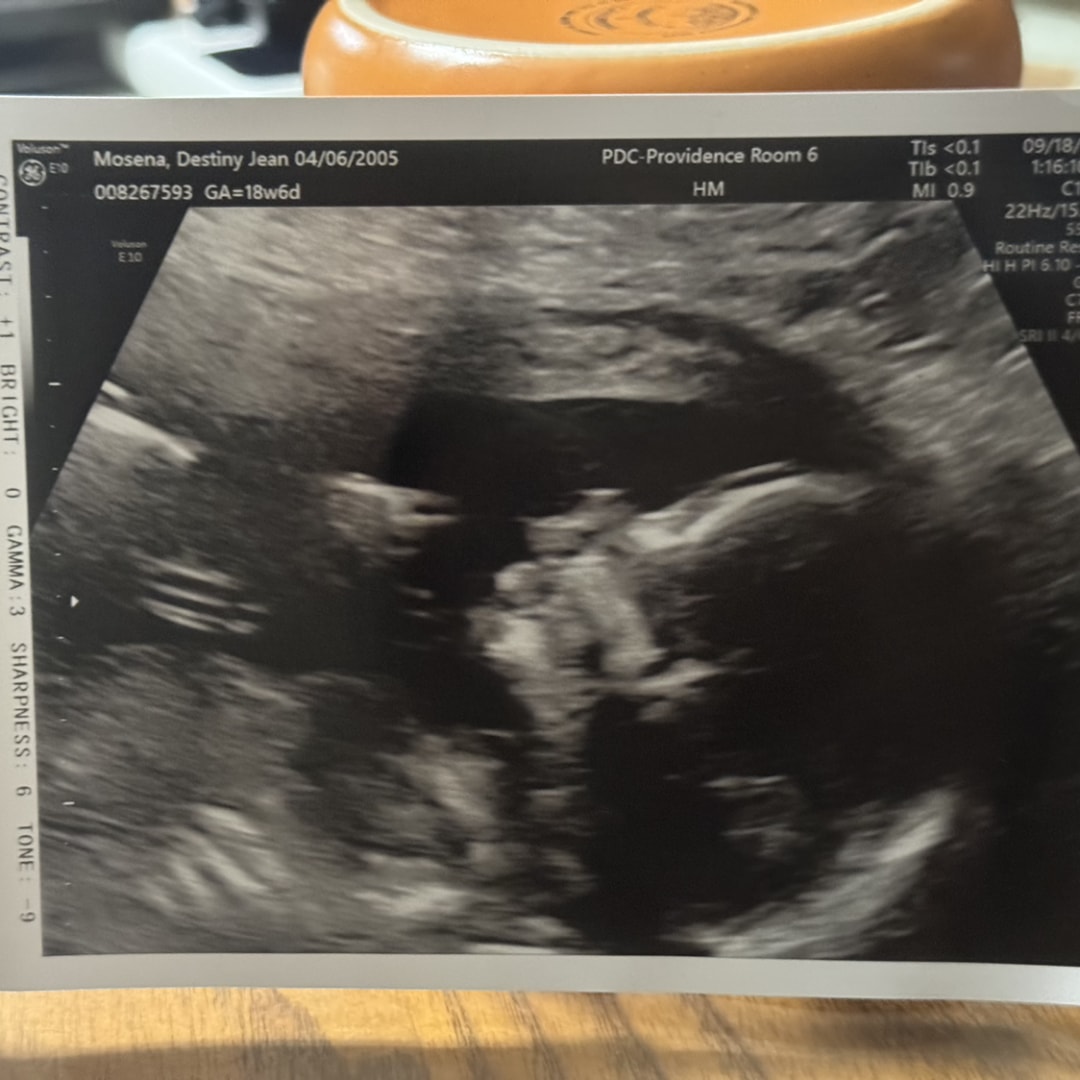 Photo shared by Destiny for their Babylist baby registry.
