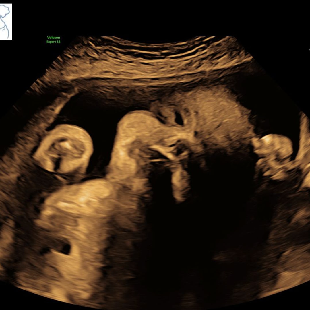Photo shared by Rona for their Babylist baby registry.