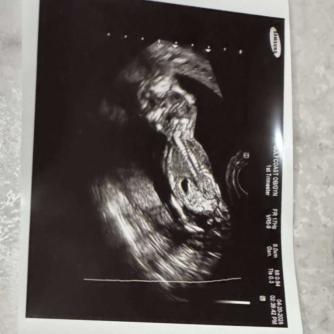 Photo shared by Alyssa for their Babylist baby registry.