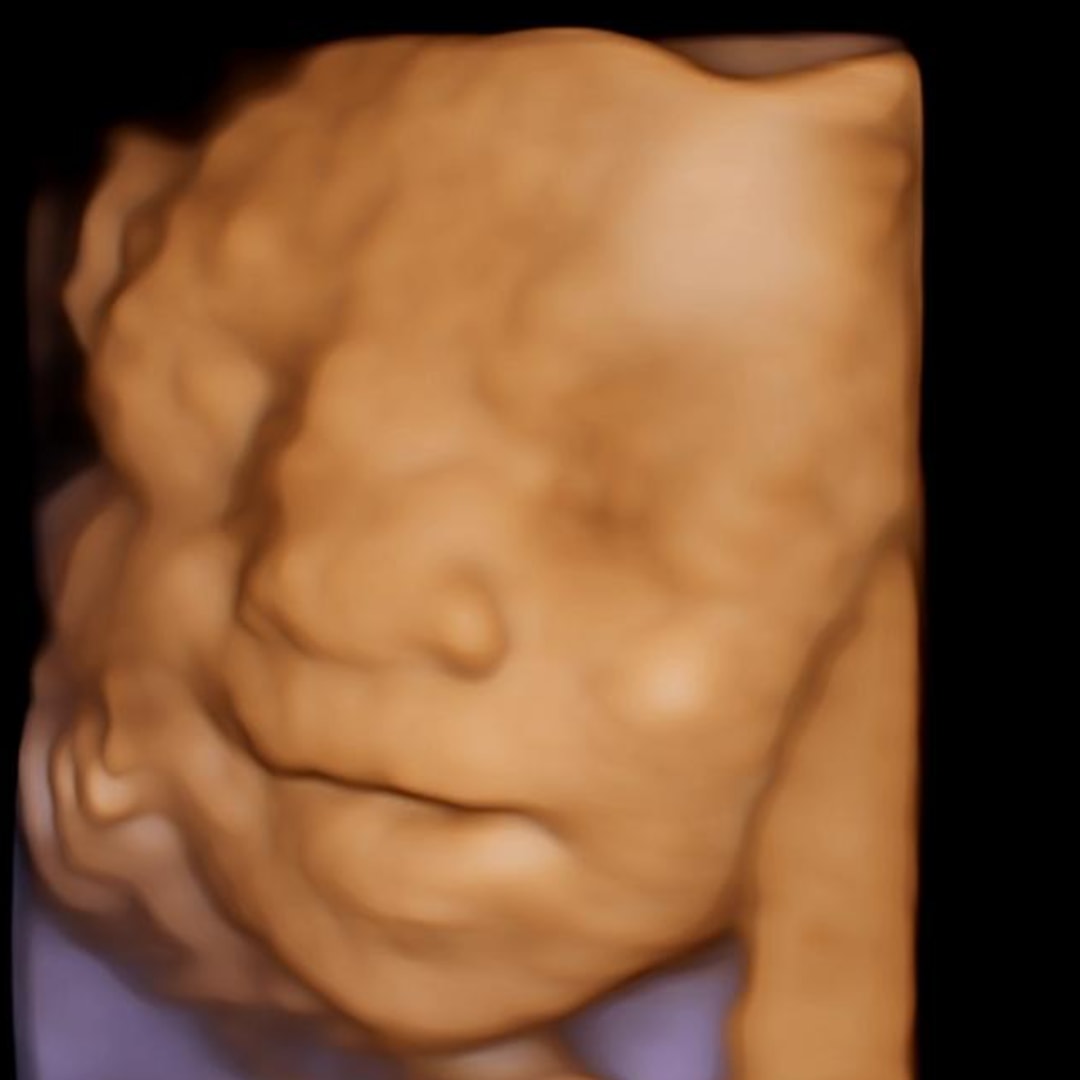 Photo shared by Riley & Gavin for their Babylist baby registry.