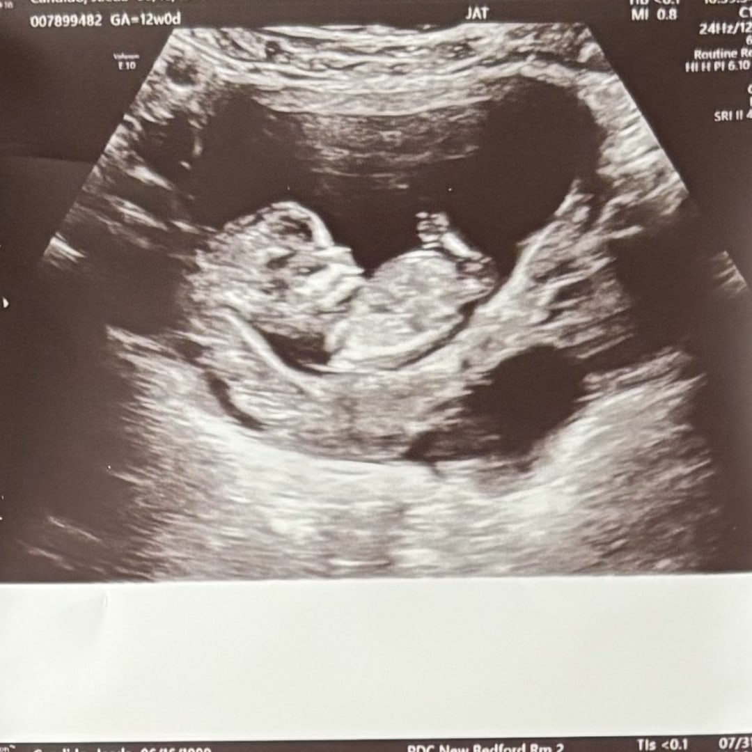Photo shared by Jaeda for their Babylist baby registry.