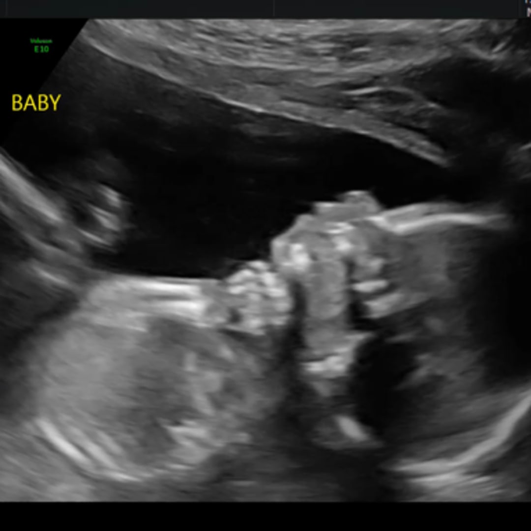 Photo shared by Ariy for their Babylist baby registry.