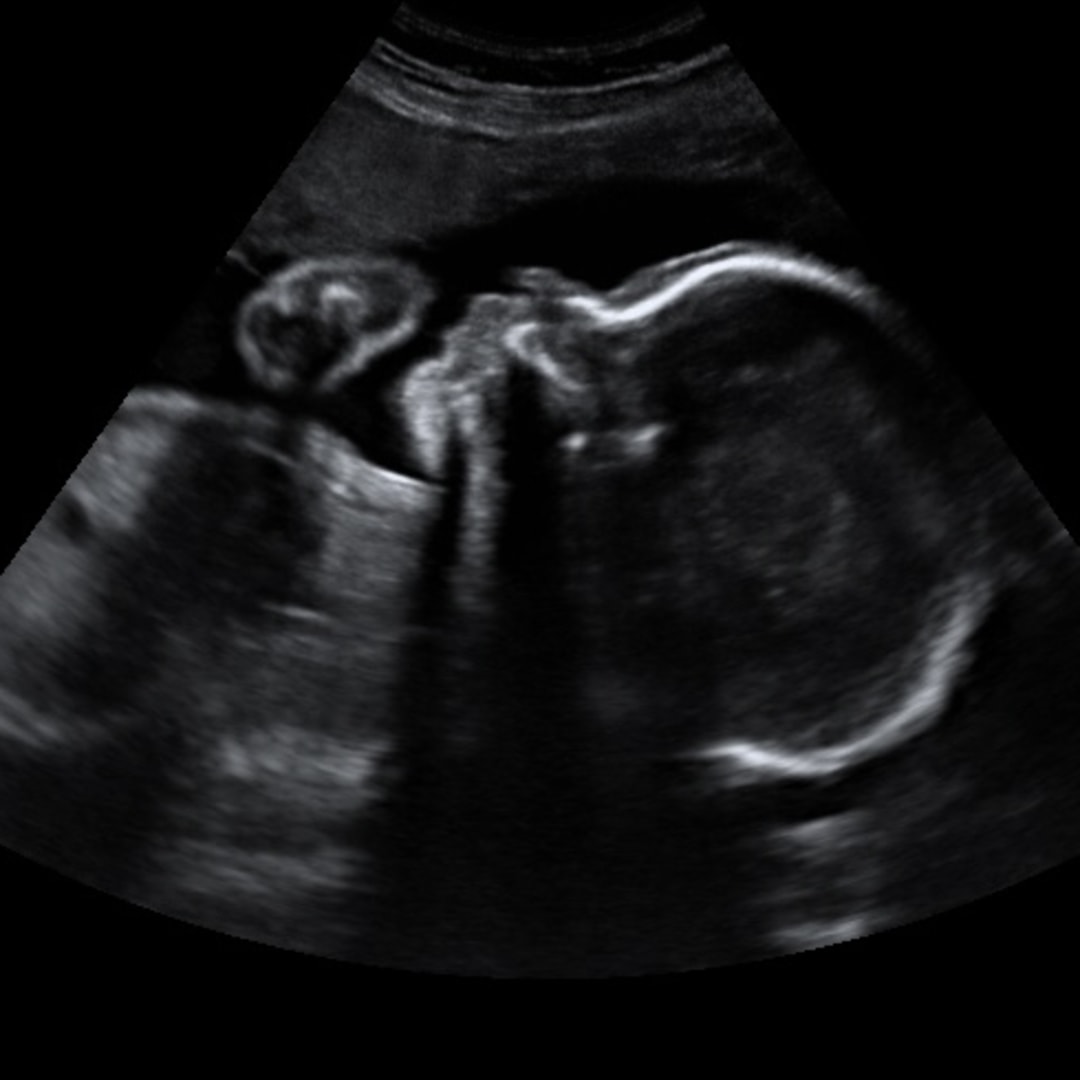 Photo shared by Briseis for their Babylist baby registry.