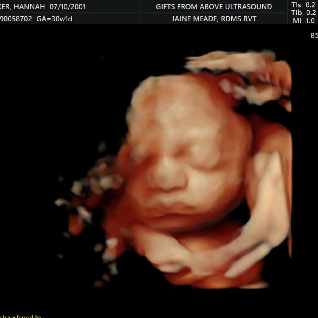 Photo shared by Hannah for their Babylist baby registry.