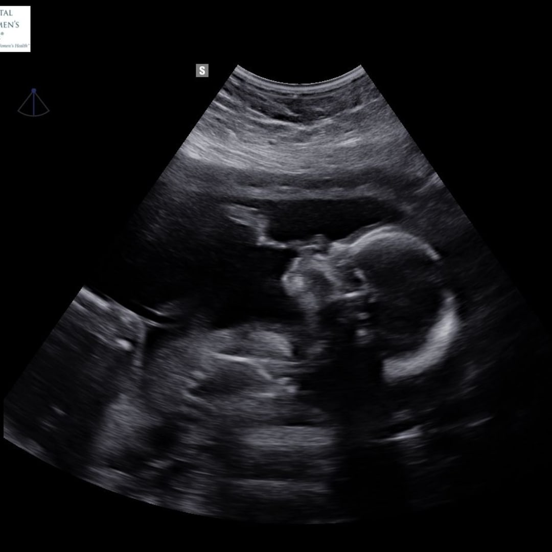 Photo shared by Sarah for their Babylist baby registry.