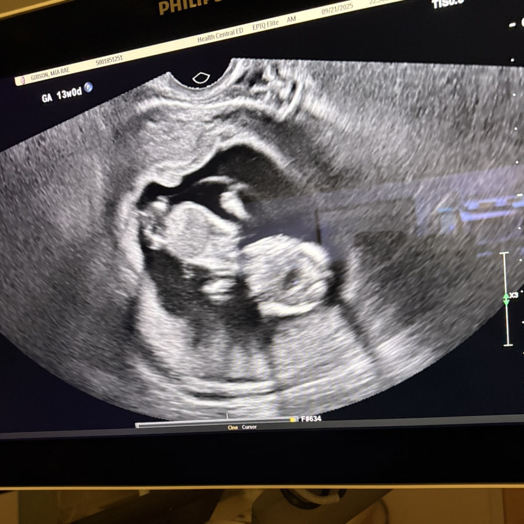 Photo shared by Mia for their Babylist baby registry.