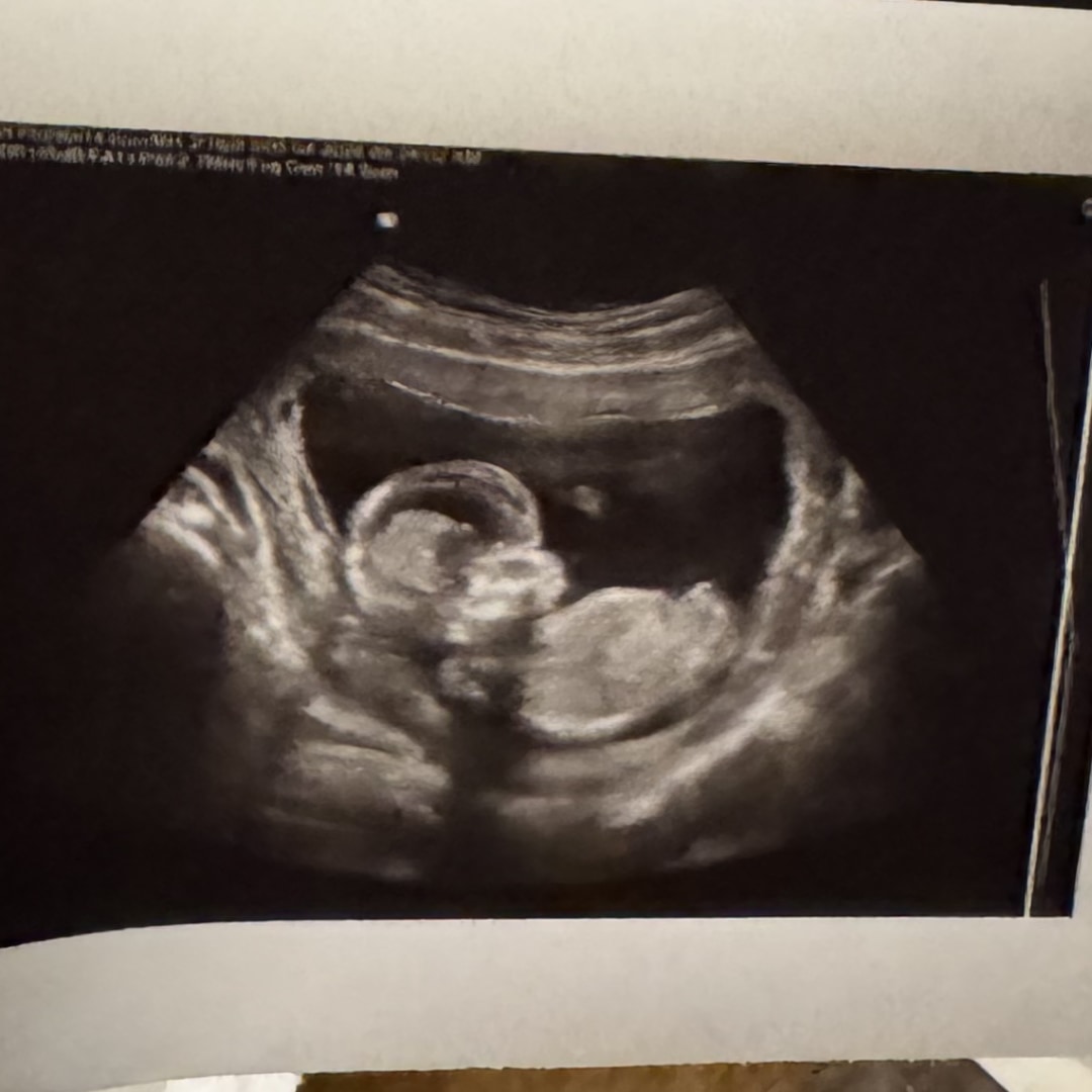 Photo shared by Wendy for their Babylist baby registry.