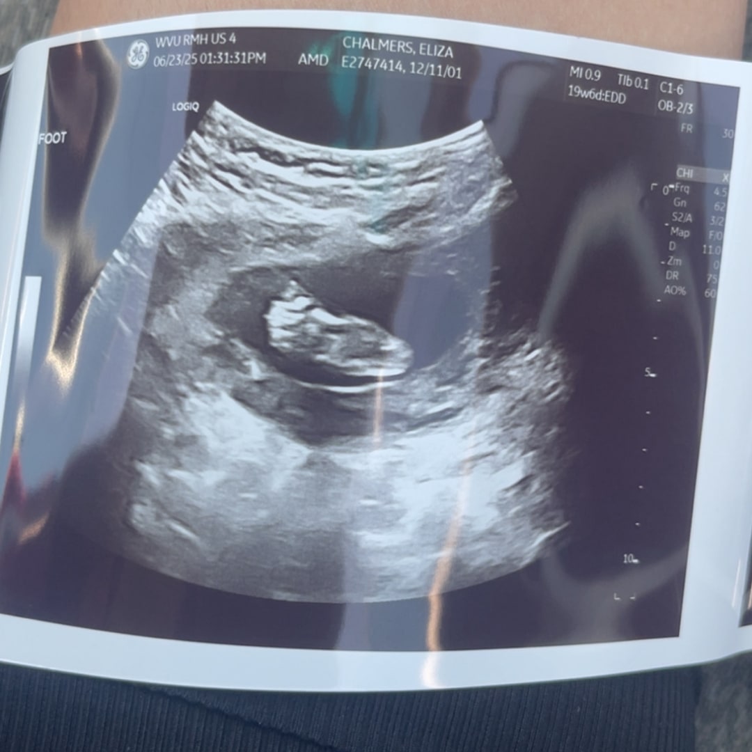 Photo shared by Eliza for their Babylist baby registry.