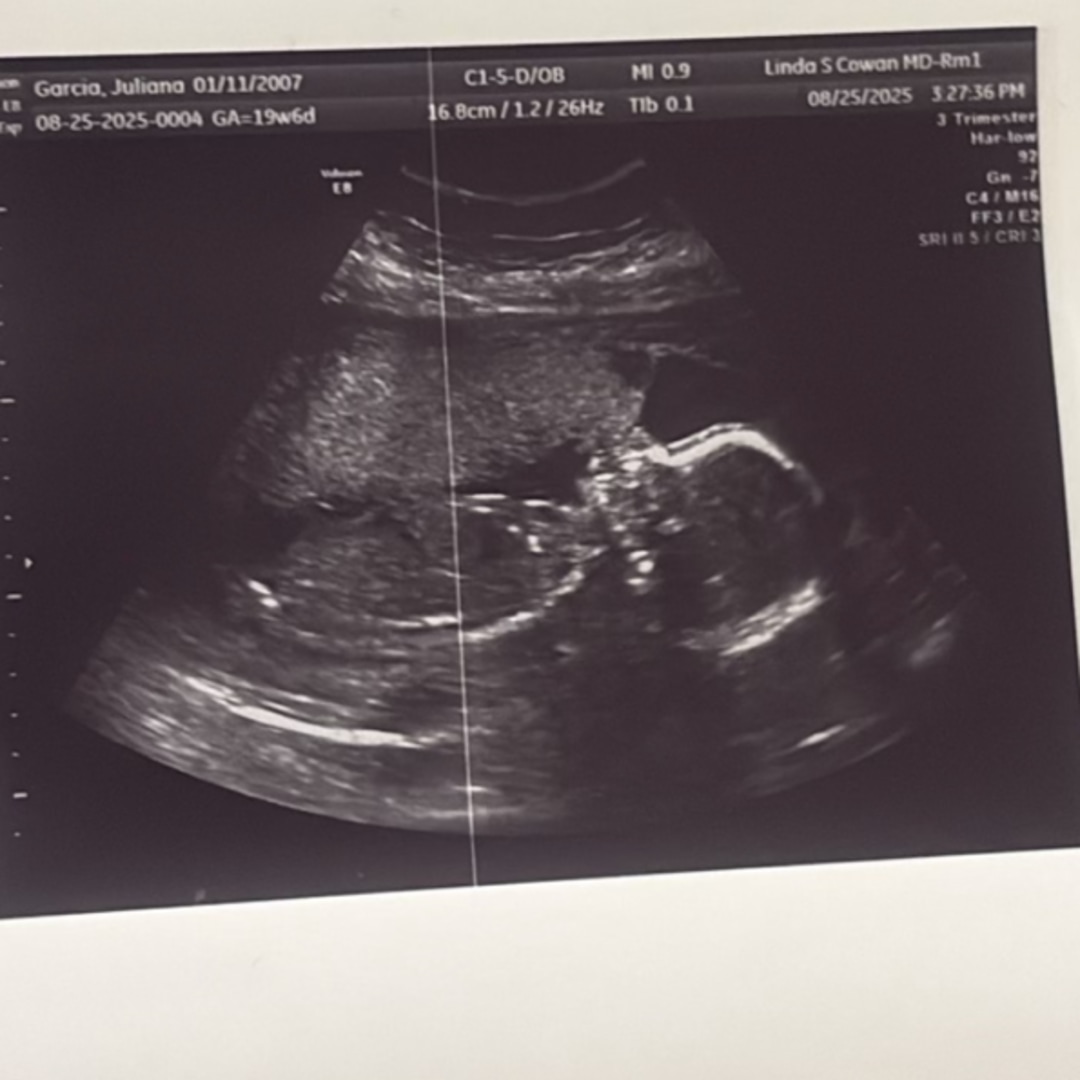 Photo shared by Juliana for their Babylist baby registry.