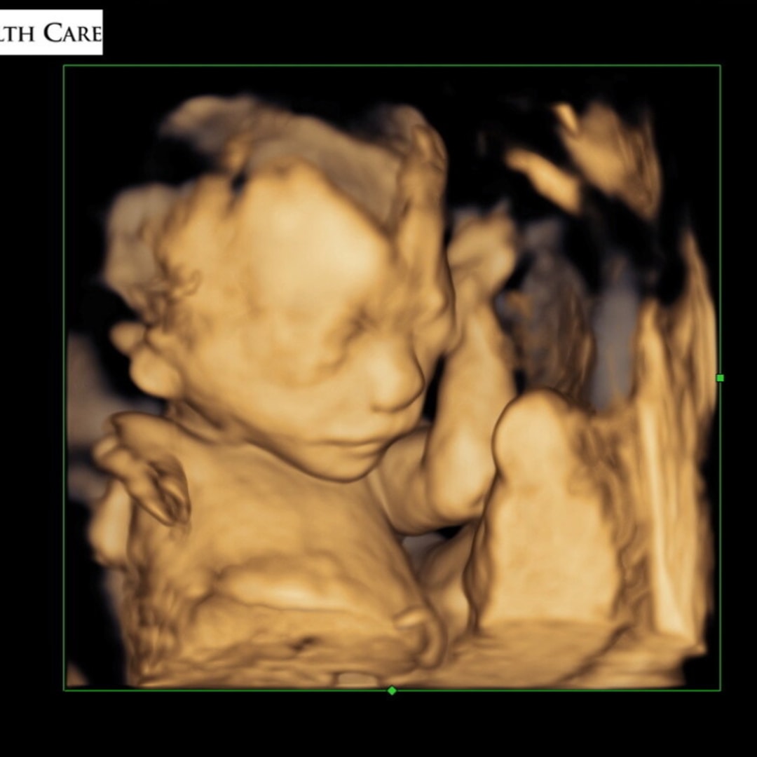 Photo shared by Yaneth for their Babylist baby registry.