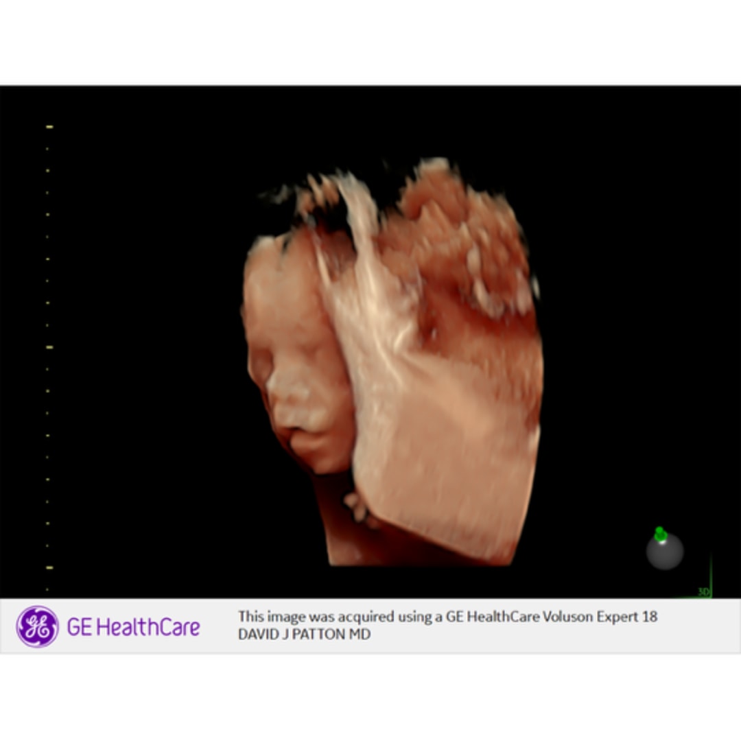 Photo shared by Annie & Carter for their Babylist baby registry.